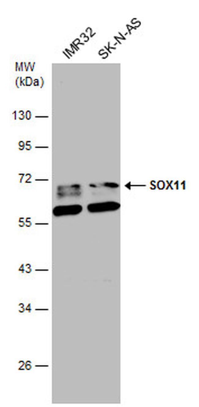 SOX11 Antibody in Western Blot (WB)