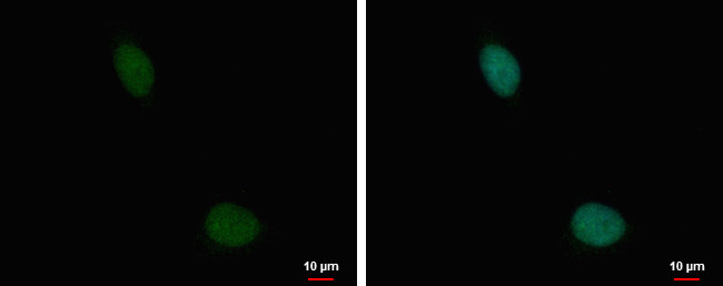 TRRAP Antibody in Immunocytochemistry (ICC/IF)