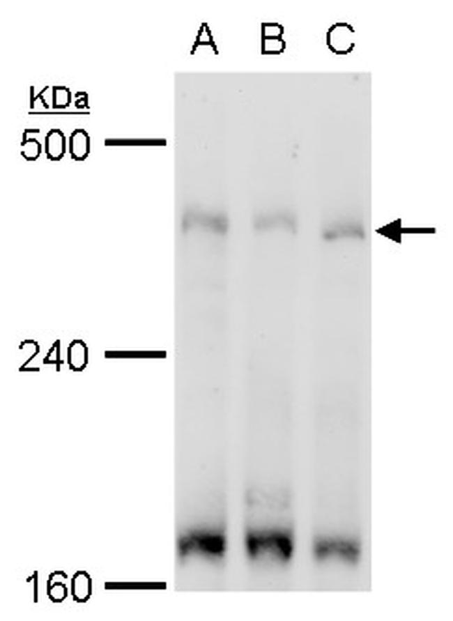 TRRAP Antibody in Western Blot (WB)