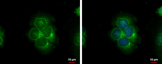 S100A9 Antibody in Immunocytochemistry (ICC/IF)