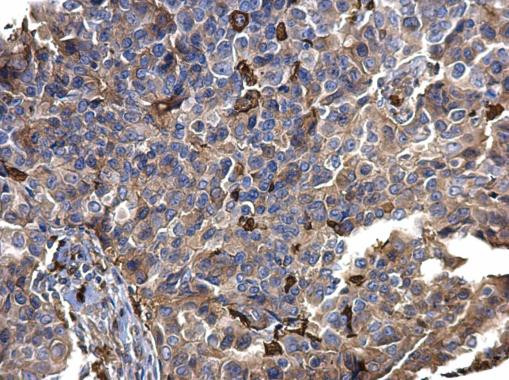 S100A9 Antibody in Immunohistochemistry (Paraffin) (IHC (P))