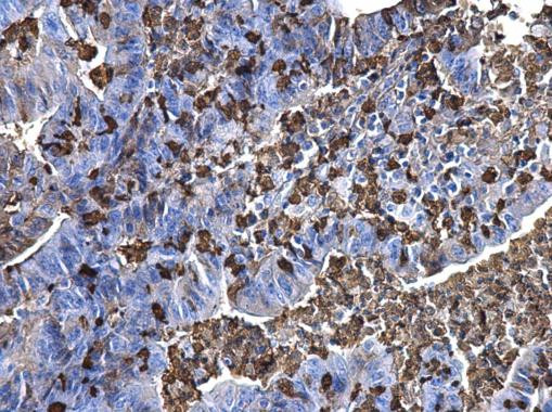 S100A9 Antibody in Immunohistochemistry (Paraffin) (IHC (P))