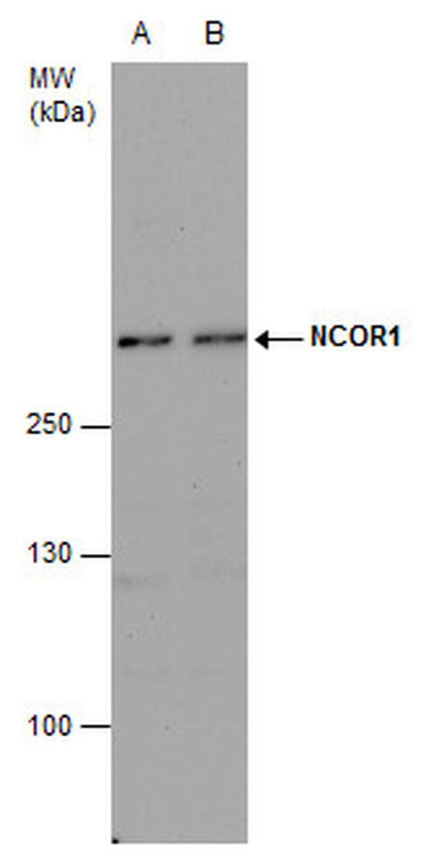 NCoR1 Antibody in Western Blot (WB)