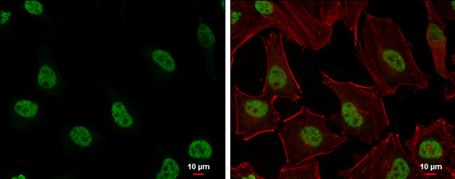 H3K27me3 Antibody in Immunocytochemistry (ICC/IF)