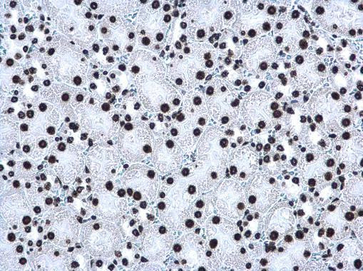 H3K27me3 Antibody in Immunohistochemistry (Paraffin) (IHC (P))