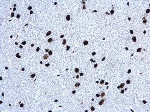 H3K27me3 Antibody in Immunohistochemistry (Paraffin) (IHC (P))