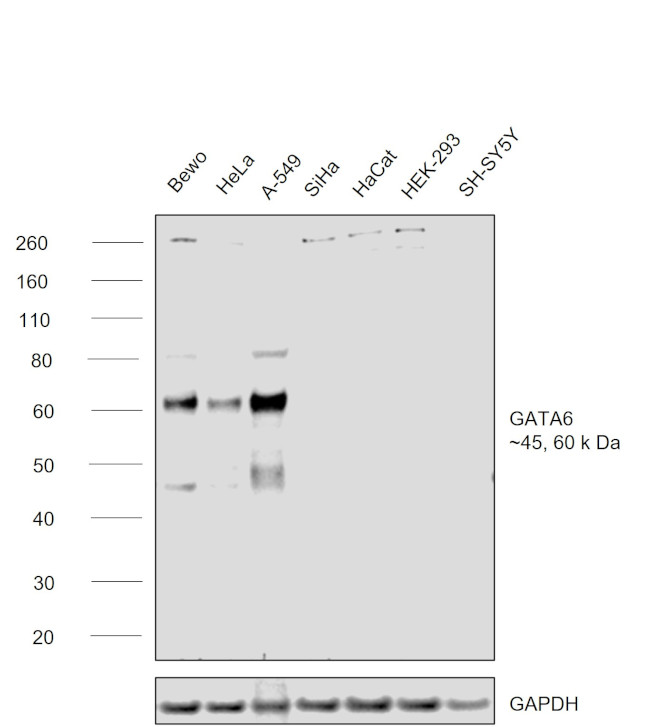 GATA6 Antibody in Western Blot (WB)