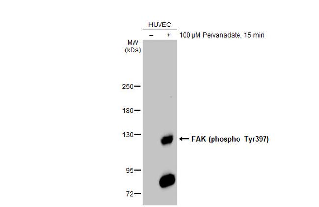 Phospho-FAK (Tyr397) Antibody in Western Blot (WB)