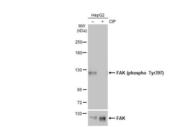 Phospho-FAK (Tyr397) Antibody in Western Blot (WB)