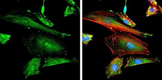 Phospho-FAK (Tyr397) Antibody in Immunocytochemistry (ICC/IF)