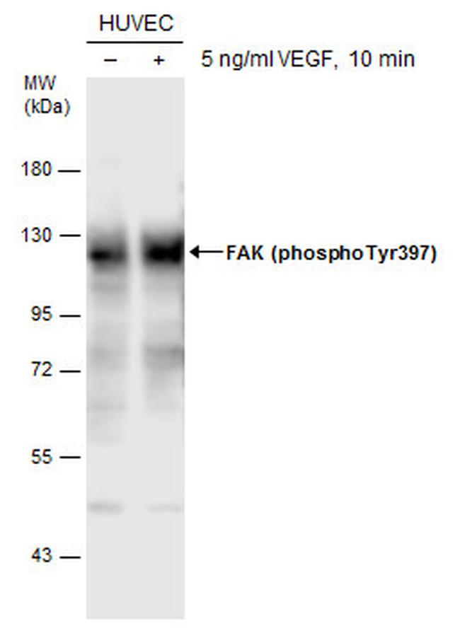 Phospho-FAK (Tyr397) Antibody in Western Blot (WB)