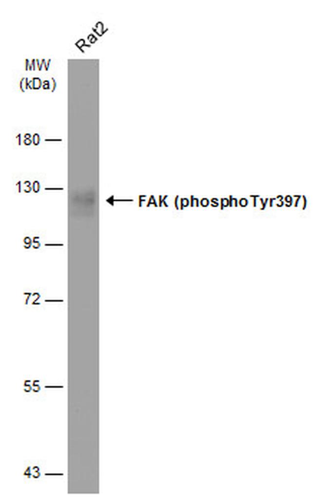 Phospho-FAK (Tyr397) Antibody in Western Blot (WB)