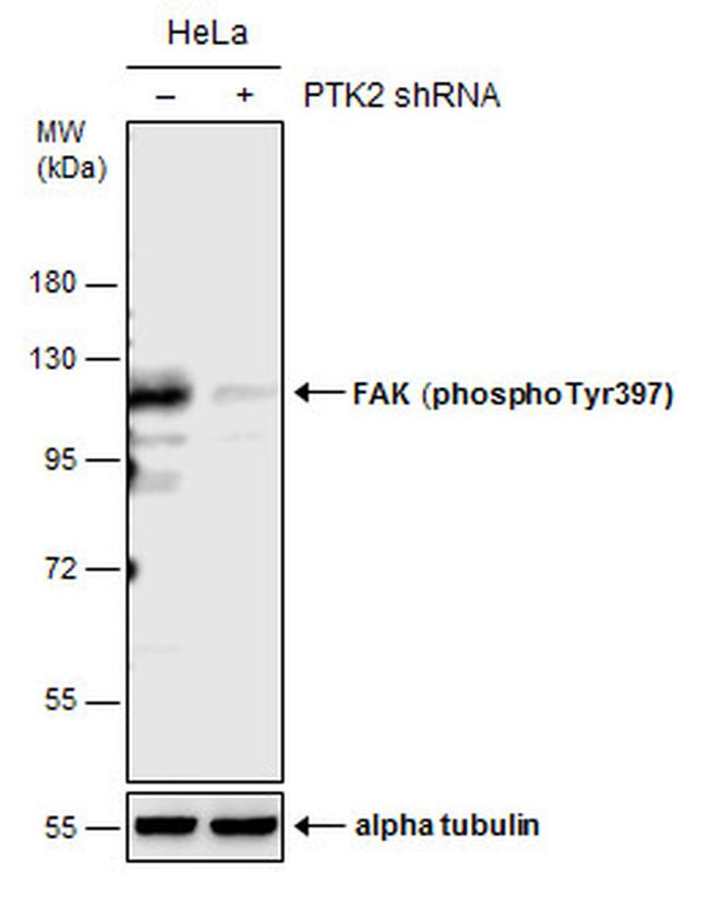 Phospho-FAK (Tyr397) Antibody in Western Blot (WB)