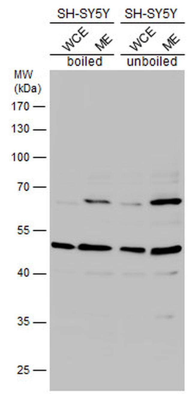 HTR2B Antibody in Western Blot (WB)