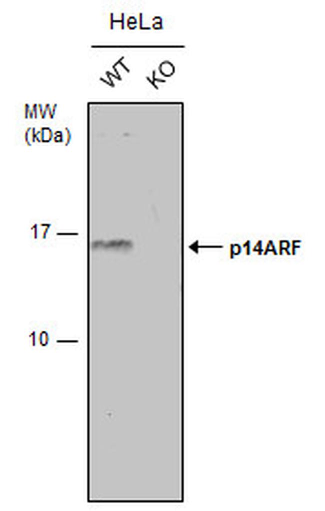 p14ARF Antibody in Western Blot (WB)