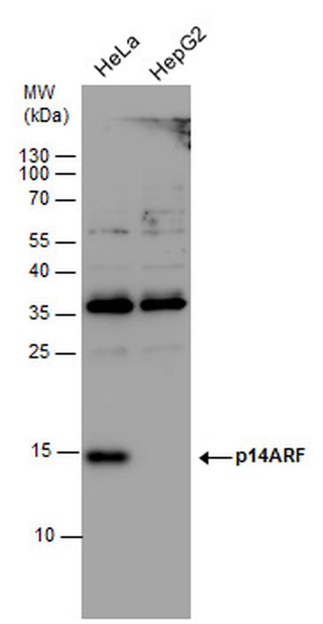 p14ARF Antibody in Western Blot (WB)