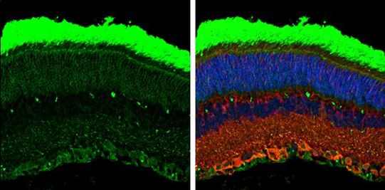 Rhodopsin Antibody in Immunohistochemistry (Paraffin) (IHC (P))