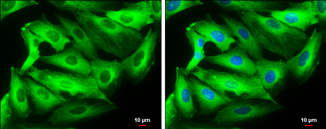 beta-3 Tubulin Antibody in Immunocytochemistry (ICC/IF)