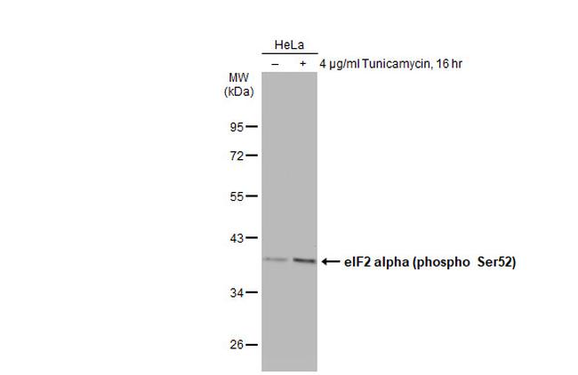 Phospho-EIF2S1 (Ser52) Antibody in Western Blot (WB)