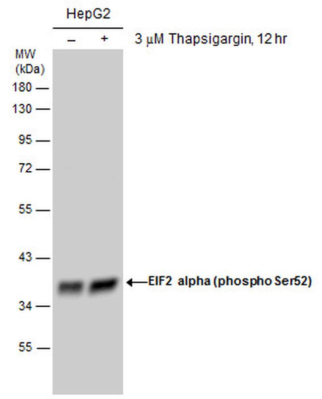 Phospho-EIF2S1 (Ser52) Antibody in Western Blot (WB)
