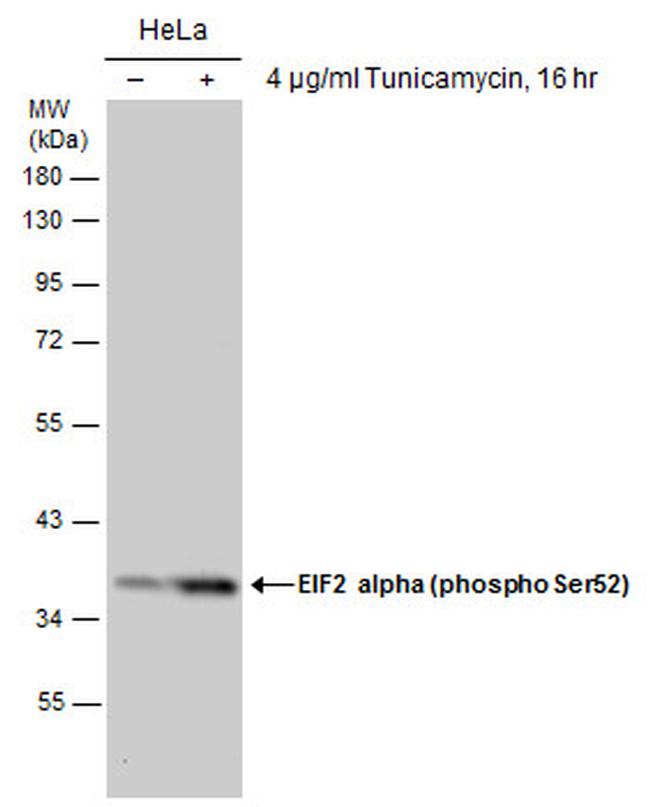 Phospho-EIF2S1 (Ser52) Antibody in Western Blot (WB)