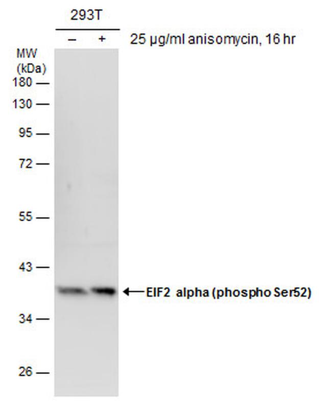 Phospho-EIF2S1 (Ser52) Antibody in Western Blot (WB)