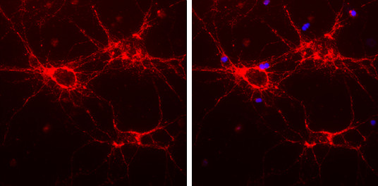 alpha Internexin Antibody in Immunocytochemistry (ICC/IF)