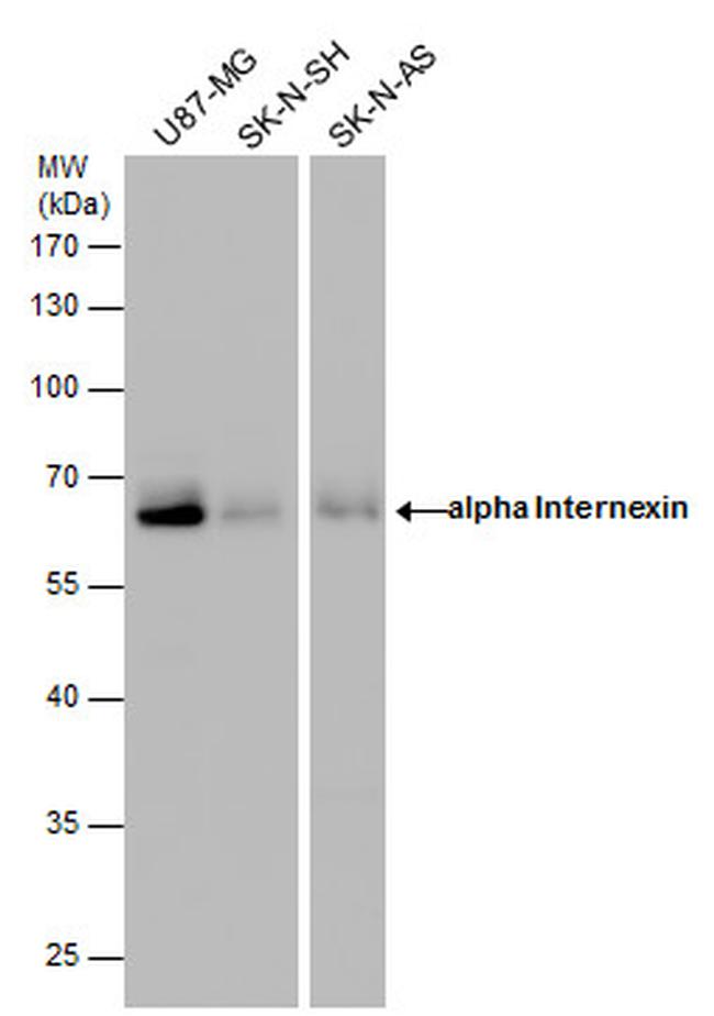 alpha Internexin Antibody in Western Blot (WB)