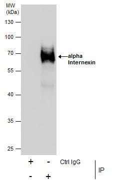 alpha Internexin Antibody in Immunoprecipitation (IP)