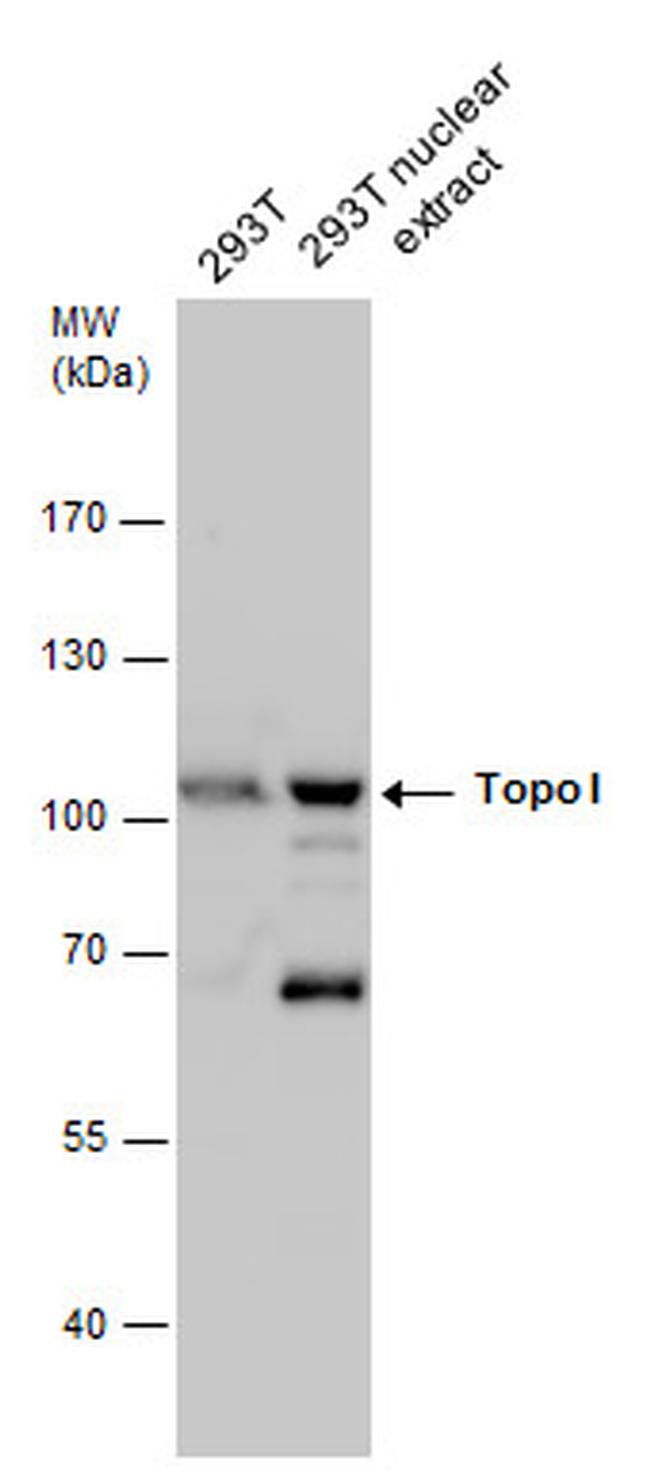 TOP1 Antibody in Western Blot (WB)