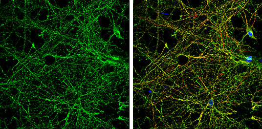 NMDAR2B Antibody in Immunocytochemistry (ICC/IF)