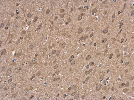 NMDAR2B Antibody in Immunohistochemistry (Paraffin) (IHC (P))