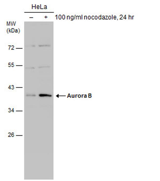 Aurora B Antibody in Western Blot (WB)