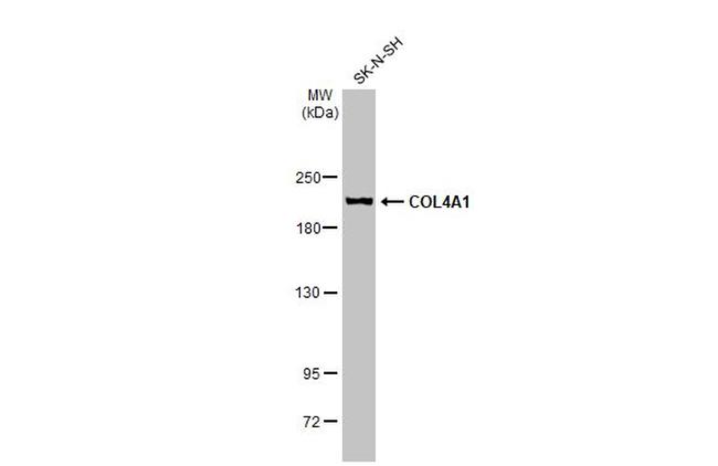 COL4A1 Antibody in Western Blot (WB)