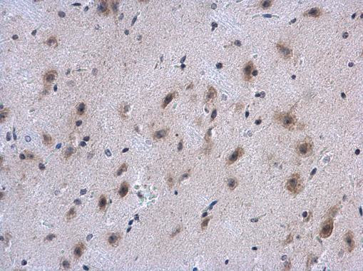 COL4A1 Antibody in Immunohistochemistry (Paraffin) (IHC (P))