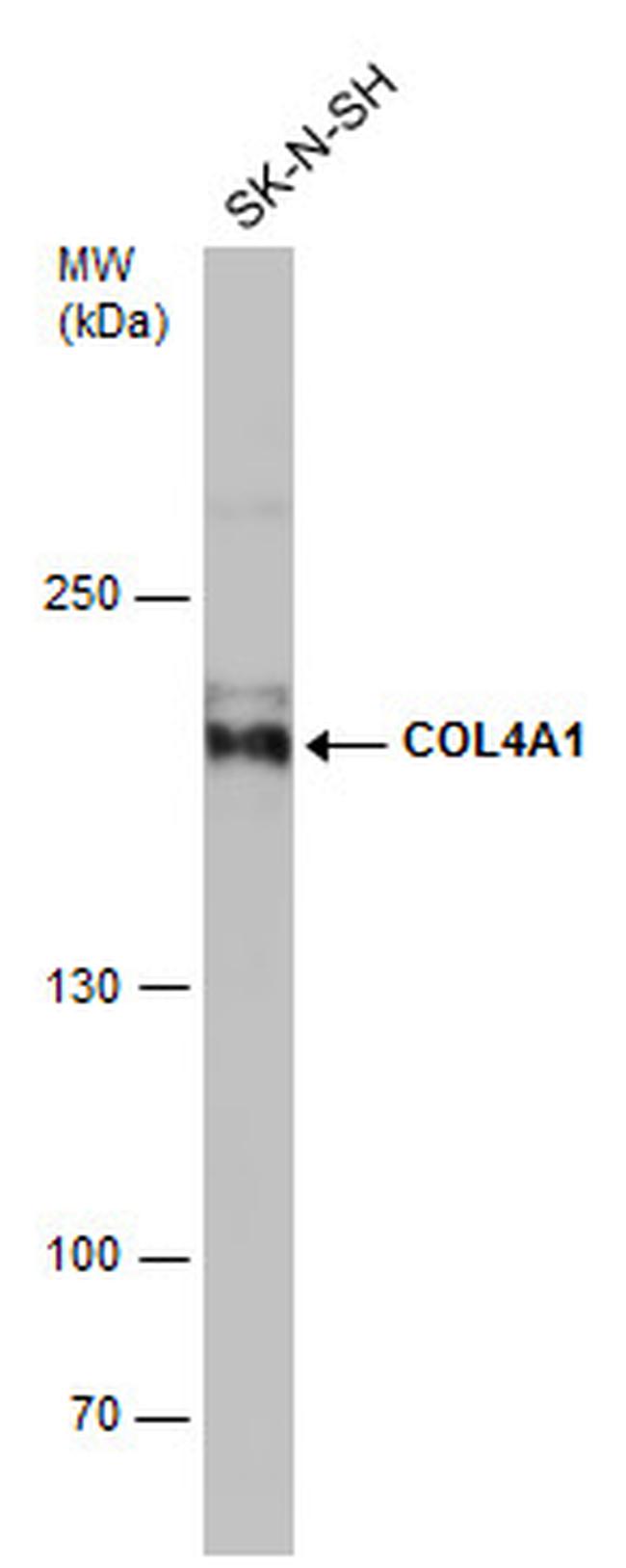 COL4A1 Antibody in Western Blot (WB)