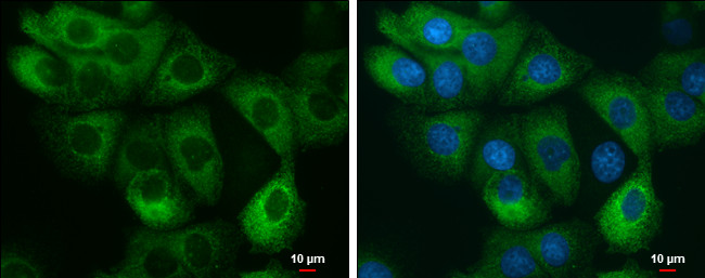 AGR2 Antibody in Immunocytochemistry (ICC/IF)