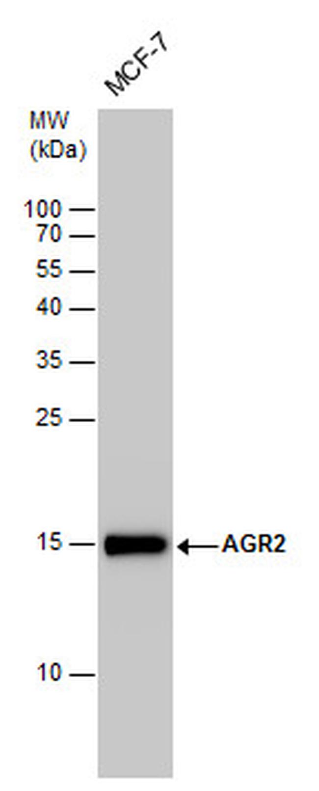 AGR2 Antibody in Western Blot (WB)