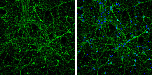 beta-3 Tubulin Antibody in Immunocytochemistry (ICC/IF)