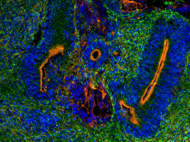 beta-3 Tubulin Antibody in Immunocytochemistry (ICC/IF)