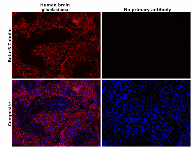 beta-3 Tubulin Antibody in Immunohistochemistry (Paraffin) (IHC (P))