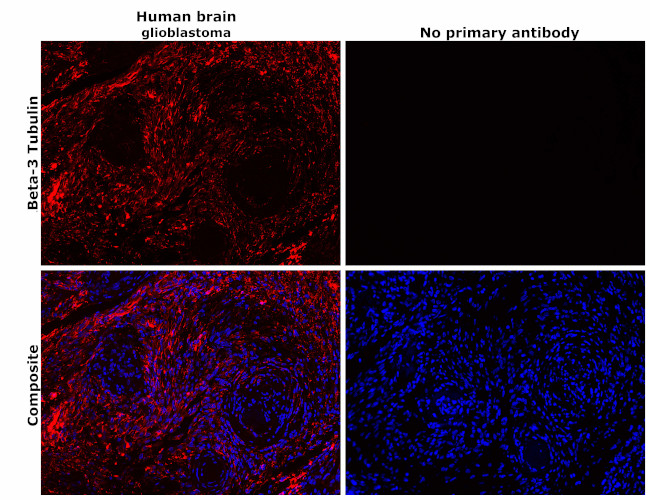 beta-3 Tubulin Antibody in Immunohistochemistry (Paraffin) (IHC (P))