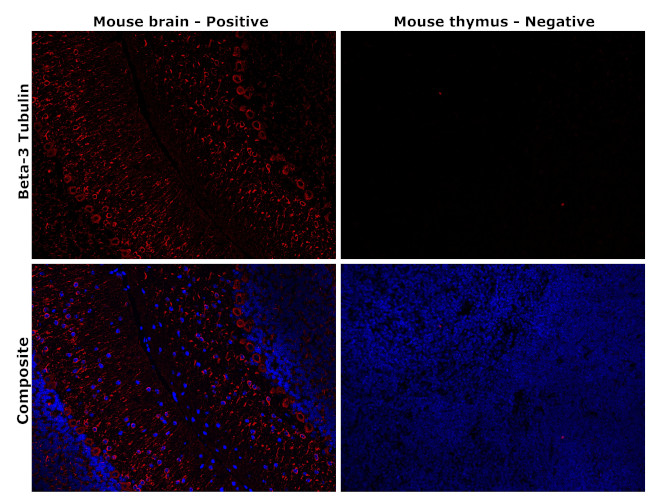 beta-3 Tubulin Antibody in Immunohistochemistry (Paraffin) (IHC (P))