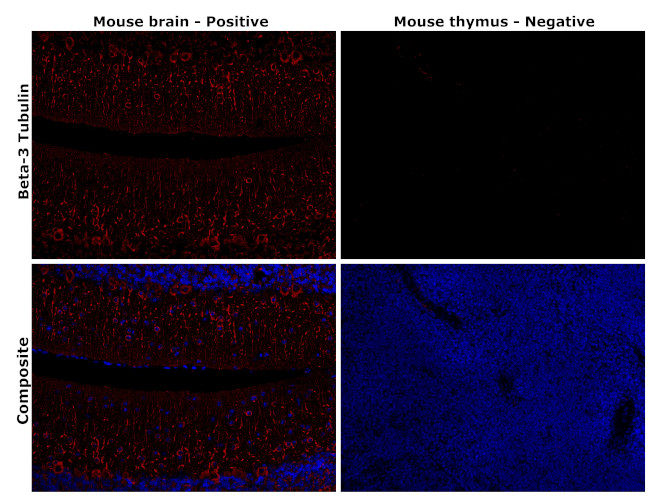 beta-3 Tubulin Antibody in Immunohistochemistry (Paraffin) (IHC (P))