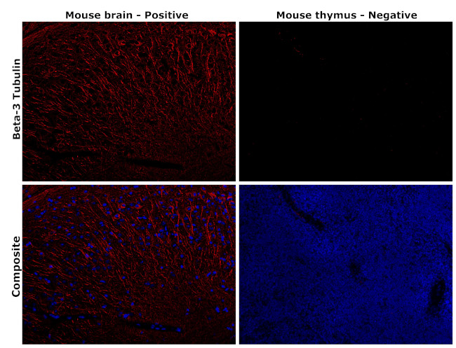 beta-3 Tubulin Antibody in Immunohistochemistry (Paraffin) (IHC (P))