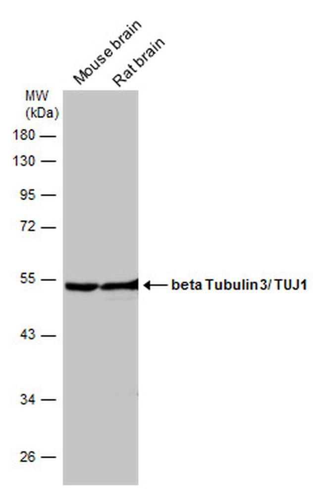 beta-3 Tubulin Antibody in Western Blot (WB)