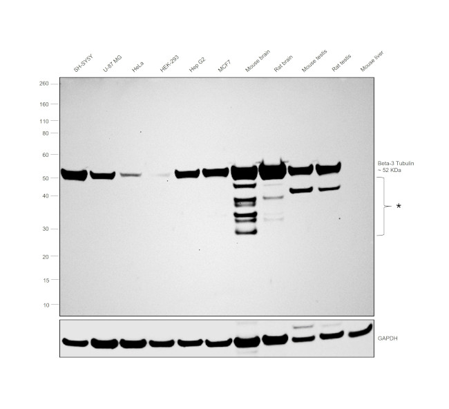 beta-3 Tubulin Antibody in Western Blot (WB)