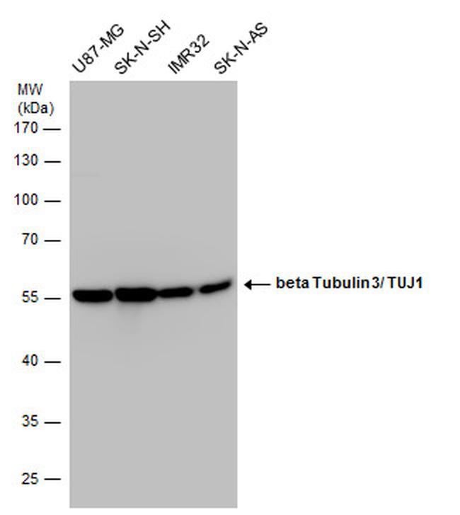 beta-3 Tubulin Antibody in Western Blot (WB)