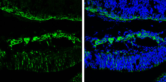 beta-3 Tubulin Antibody in Immunohistochemistry (Frozen) (IHC (F))