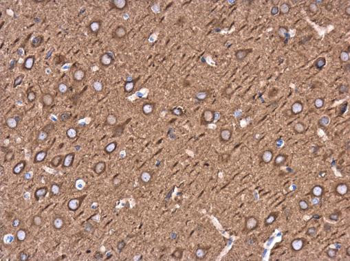 beta-3 Tubulin Antibody in Immunohistochemistry (Paraffin) (IHC (P))